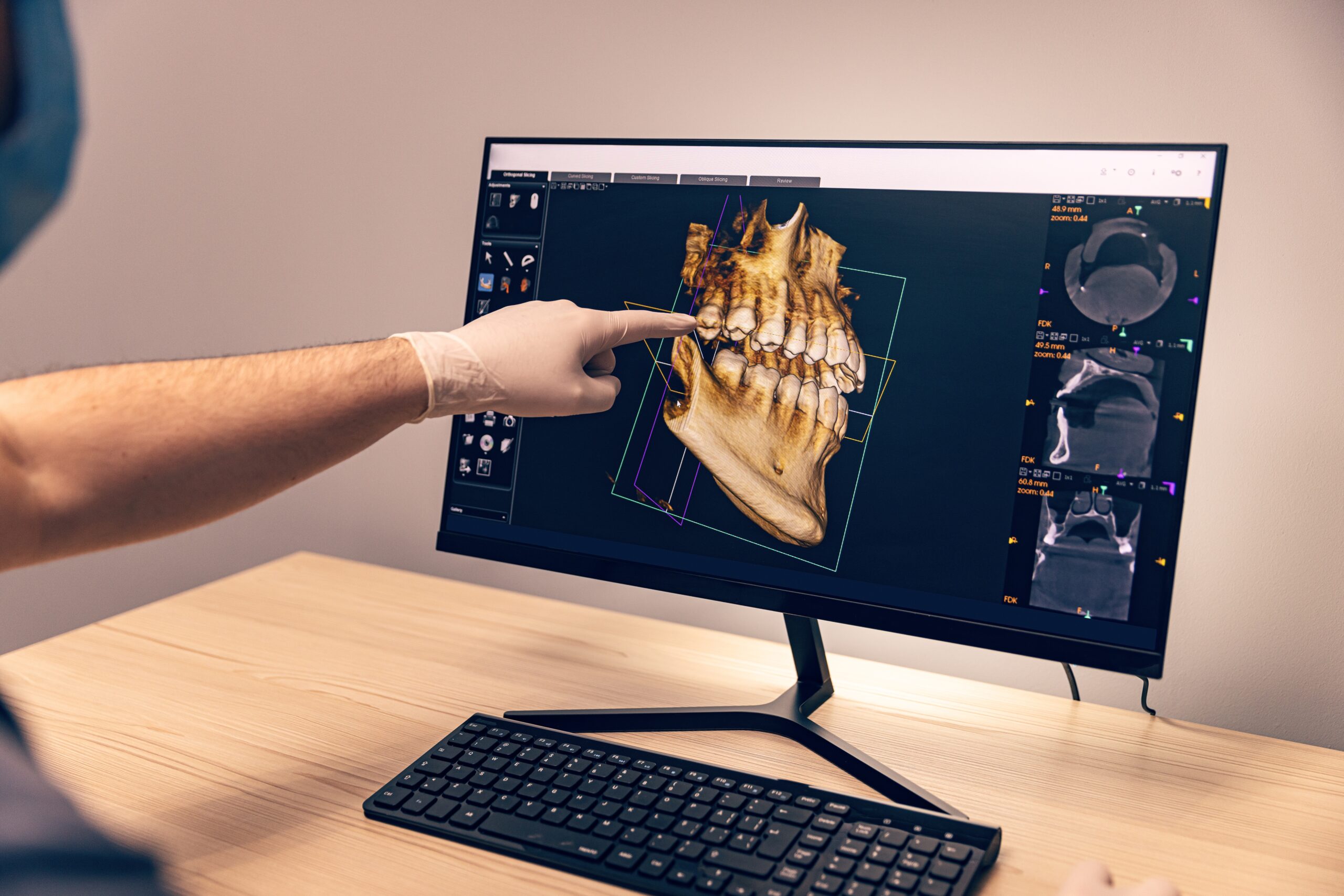 https://www.docteur-bioteau.fr/wp-content/uploads/2023/03/CBCT-scaled.jpg