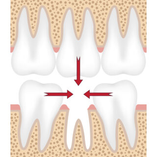 https://www.docteur-bioteau.fr/wp-content/uploads/2023/03/shutterstock_379815100-320x320.jpg