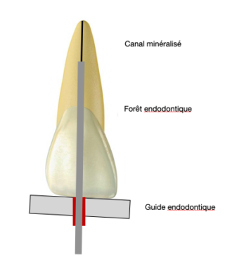 https://www.docteur-bioteau.fr/wp-content/uploads/2023/05/Capture-decran-2023-05-14-a-21.45.53-320x376.png